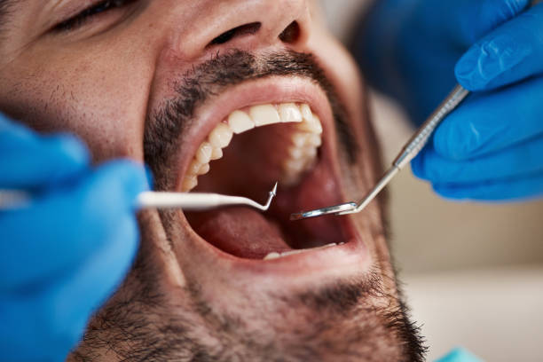 Best Emergency Dental Surgery in West York, PA